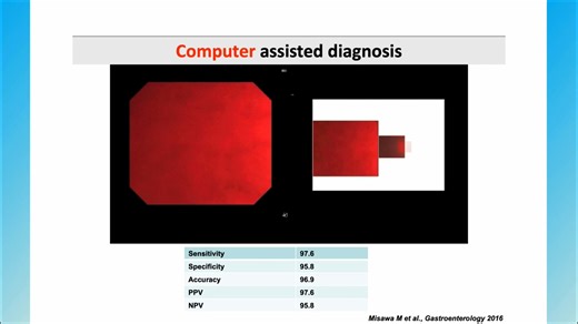 What is the probability of AI taking over diagnostic medicine? This video emphasizes the importance of continuing to train the human eye, even as AI progresses. • AI's potential in diagnosis is undeniable. • However, the human element remains critical. • Expertise in visual pattern recognition is essential. Watch the full lecture and explore our complete course library at EndoCollab.com. #gastroenterology #gastroenterologia #endoscopy #endoscopia | EndoCollab