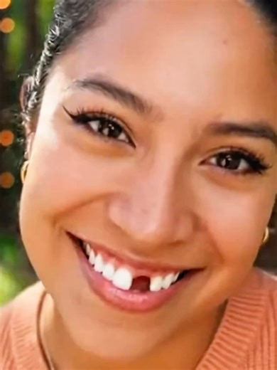 Achieve Your Best Smile with Moldable False Teeth