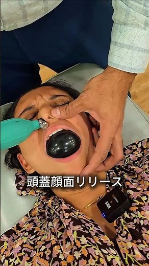 A procedure in which a balloon inserted into the nose is expelled from the mouth.