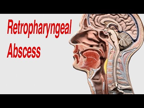 Retropharyngeal Abscess: Anatomy and Treatment