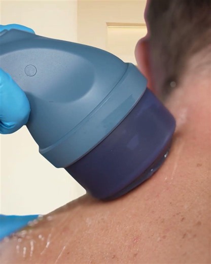 Deep tissue pain can be challenging to treat