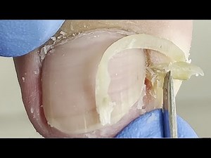 Relaxing Pedicure: Professional Foot Care【Xue Yidao】