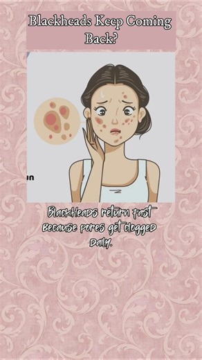 Blackheads Keep Coming Back? Do THIS🔥 #makeuphacks #youtubeshorts #trending #glowup #shorts