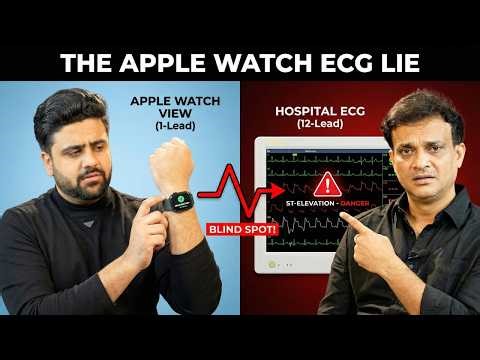 The Apple Watch ECG "Lie": Why It Misses Heart Attacks
