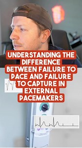 8.2K views · 5 comments | Failure to capture vs failure to pace! . Follow for more ICU nursing education!  . #cvicu #cardiacnurse #criticalcare #nursingschool #icunurse #newgradnurse #newgradrn #nursesofinstagram #icunurselife #flightnurse #criticalcarenurse #emergencydepartment #nurselife #paramedic #ernurses | Nurse Dose Podcast | Facebook