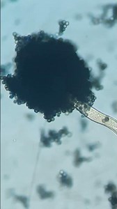 Aspergillus niger in LPCB #microscope #shorts