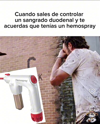 Hemospray en Sangrado Duodenal: 5 Puntos Clave