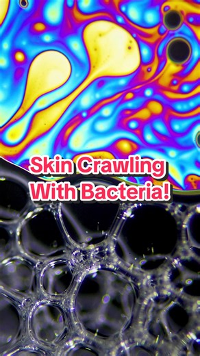 What lives in your skin microbiome