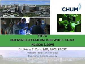 Greenlight XPS - Step 4 • Video • MEDtube.net