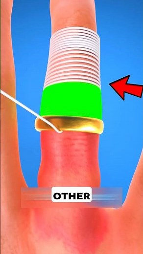 How to Remove a Stuck Ring in Seconds? 💍