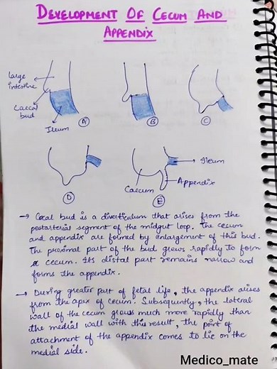 Development of Cecum and Appendix (embryology) 🩺 #mbbs #anatomy #embryology #notes