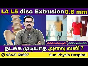 L4-L5 Disc Extrusion 0.8mm | Surgery Survivor | Sun Physio Hospital.