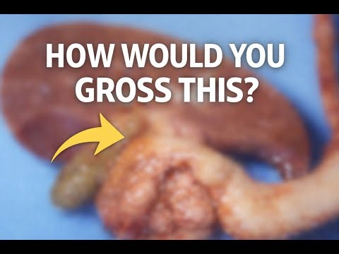 How to Answer “How Would You Gross This Specimen?” | PA Interview Prep