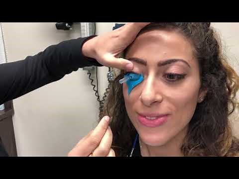 Eye Print Pro Scleral Lens