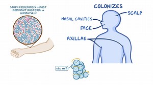 1.7K views · 27 reactions | Where is Staphylococcus epidermiditis...