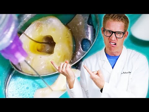Dentist Explains Every TOOTH PAIN AFTER ROOT CANAL TREATMENT? Throbbing Relief Months or Years Later