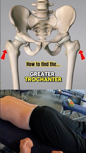 How to find the greater trochanter
