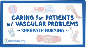 Caring for Patients with Vascular Problems: Video, Causes, & Meaning | Osmosis