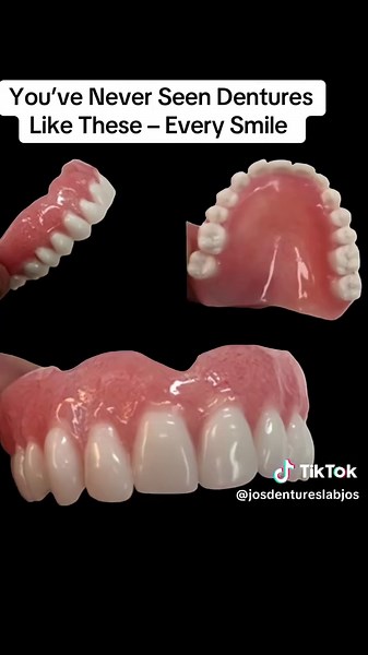 You’ve Never Seen Dentures Like These – Every Smile Take a closer look at the smiles I bring to life. These aren’t your average dentures—each one is handcrafted with precision, passion, and purpose. From natural finishes to flexible designs, this gallery proves that every smile deserves to be a masterpiece.#dentures #denturelife #denturelab #denturelove #dentureartist #denturemaker #dentureclinic #flexibledenture #customdentures #premiumdentures #smiletransformation #prostheticdentistry #denture