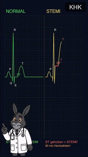 🫀 EKG einfach erklärt: STEMI vs. NSTEMI – zwei Infarkte, ein Unterschied