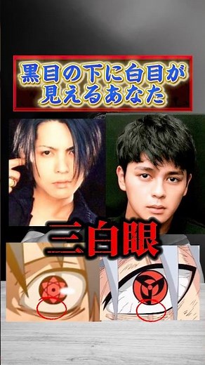【黒目の下に白目が見えるあなた！必見です！！】三白眼について！！