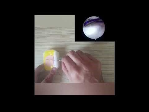 Arthroscopic Triangular Fibrocartilage Complex Repair Using Modified Outside In Technique