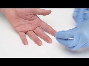 Capillary Blood Collection