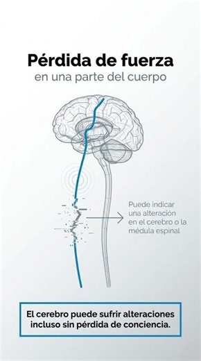 Un traumatismo craneal puede generar daño neurológico