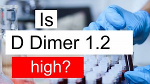 Is D Dimer 1.2 high, normal or dangerous? What does D Dimer level 1.2 mean?