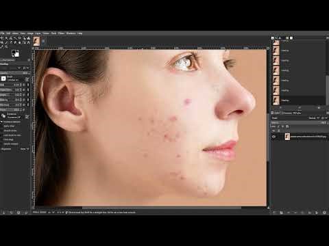 How to Fix Skin Blemishes in GIMP