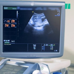 773K views · 569 reactions | The Iowa Senate has passed a law that, if approved, would be the most restrictive in the country and potentially pave the way for a rollback of reproductive rights nationwide... | Yahoo News | Facebook