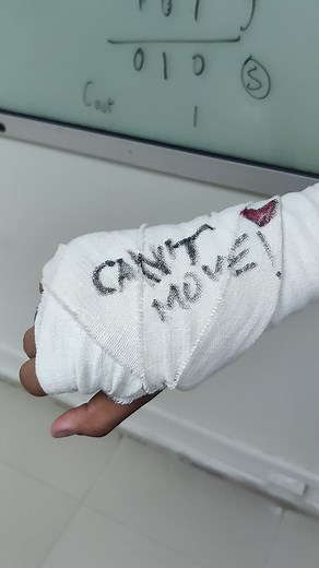 Well atleast he can do what he did 💀😂😭 #dark #darkhumour #funny #memes #relatable #broken #hand #brokenhand #bandage #doctors #university #universitymemes #evilfriends #friends #besties #bestie