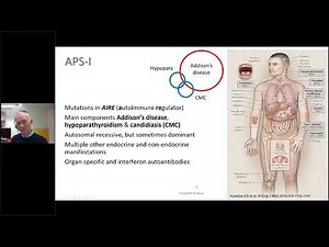 Primary adrenal insufficiency diagnosis, treatment and follow up illustrated by cases