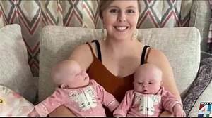 ‘Like one in 2 million’: Mom says rare twins with Down syndrome are ‘my little gems’