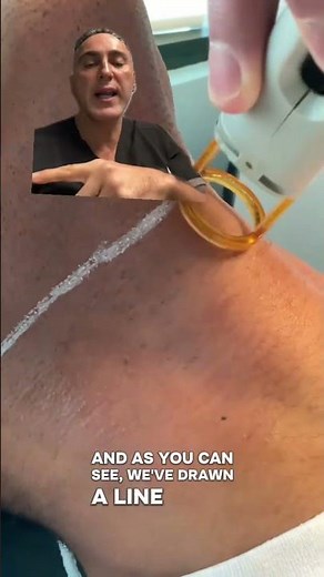 Best Solution For Razor Bumps On The Neck