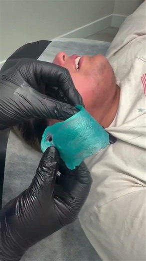 Full Face Waxing with Coral Crush Hard Wax by @modalityesthetics | Smooth Results Fast