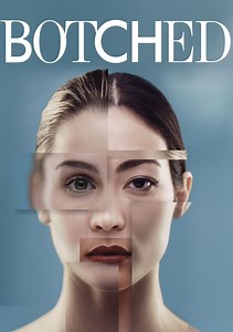 Botched Season 7 (2021), Watch Full Episodes Online on TVOnic