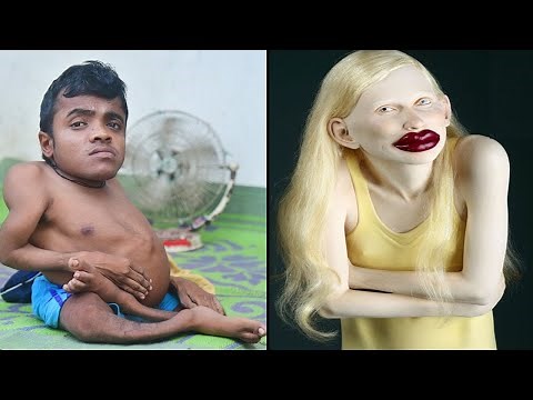 15 Extremely Unusual People You Won't Believe Exist!