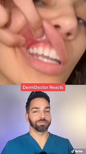 Dr. Muneeb Shah on Instagram: "Canker Sores 😣 Causes include stress, vitamin deficiencies, SLS in toothpaste, acidic foods, autoimmune conditions, and infections Most of the time, we have no idea why they happen but they’re a pain when they do Treatments: • Rinse with salt water • Numbing gels • Topical steroids (prescribed) Some studies show that sodium lauryl sulfate (SLS) in toothpaste can contribute! So consider looking for a toothpaste without this ingredient Source: Herlofson BB, Barkvoll