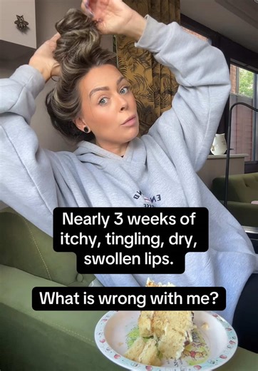 Nearly 3 weeks of itchy, tingling, dry, swollen lips and lip balm is useless 😩 Any advice before my doctor’s appt later today? At my wits end! #HelpMeTikTok #LipProblems #MedicalAdvice #FYP #SendHelp