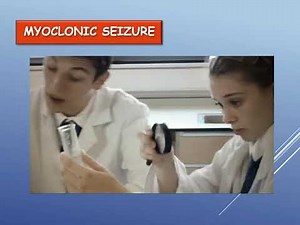 Myoclonic seizures - URIS