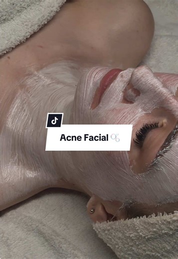 Real Skin , Real Results , Real Glow ✨🫧 Come Book your next facial with Lizard 🦎🫀 #lizardsatinskincare #licensedesthetician #acnefacial #arizona #skin