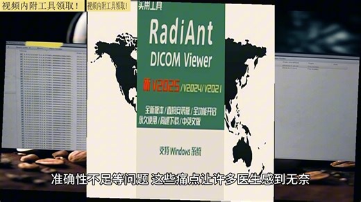 医学影像dicom标准？西门子syngo查看影像？dicom软件下载？