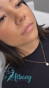 💋 Russian Lips with Juvederm – The Perfect Pout! 💋 If you love a lifted, contoured lip shape with a natural yet plump finish, Russian Lips might be your perfect match! This technique enhances the cupid’s bow, adding height and definition without excessive volume, creating a beautifully balanced, doll-like effect. ✨ For this stunning transformation, we used Juvederm lip filler to: ✔ Sculpt and lift the cupid’s bow ✔ Add volume while keeping a natural shape ✔ Smooth out fine lines for a soft, yo