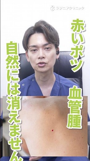 肌にできる赤いぽつ。血管腫は自然に消えません！正しい治療方法は？