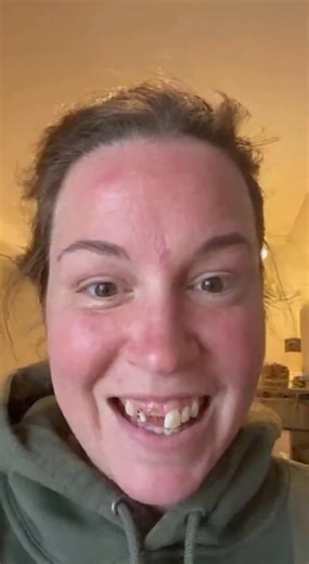 339 reactions · 17 shares | Enrollment for the New 2025 Dental Relief Program is now open! You can finally get the smile you’ve always wanted — without stressing about costs or comparing quotes. This tool automatically finds you the best deal available, and many people are shocked at how affordable it is… some are even getting theirs fully covered. The best part? No insurance needed! | Josie Turner | Facebook