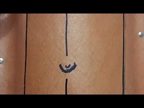 Abdominal Wall Closure - By Prof. Chintamani