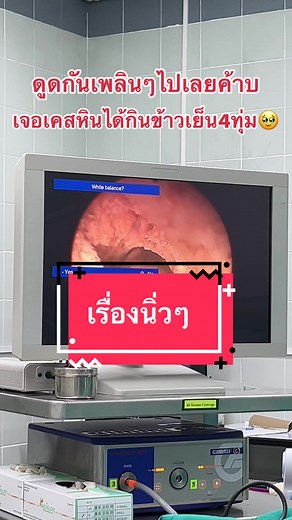 วิธีการผ่าตัดนิ่วในกระเพาะปัสสาวะ