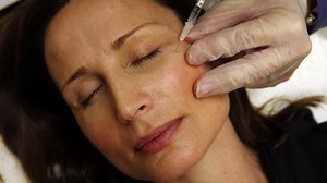 Botox 101: What you need to know about the cosmestic procedure