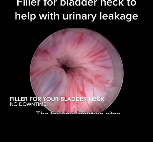 sunycamineromd on TikTok